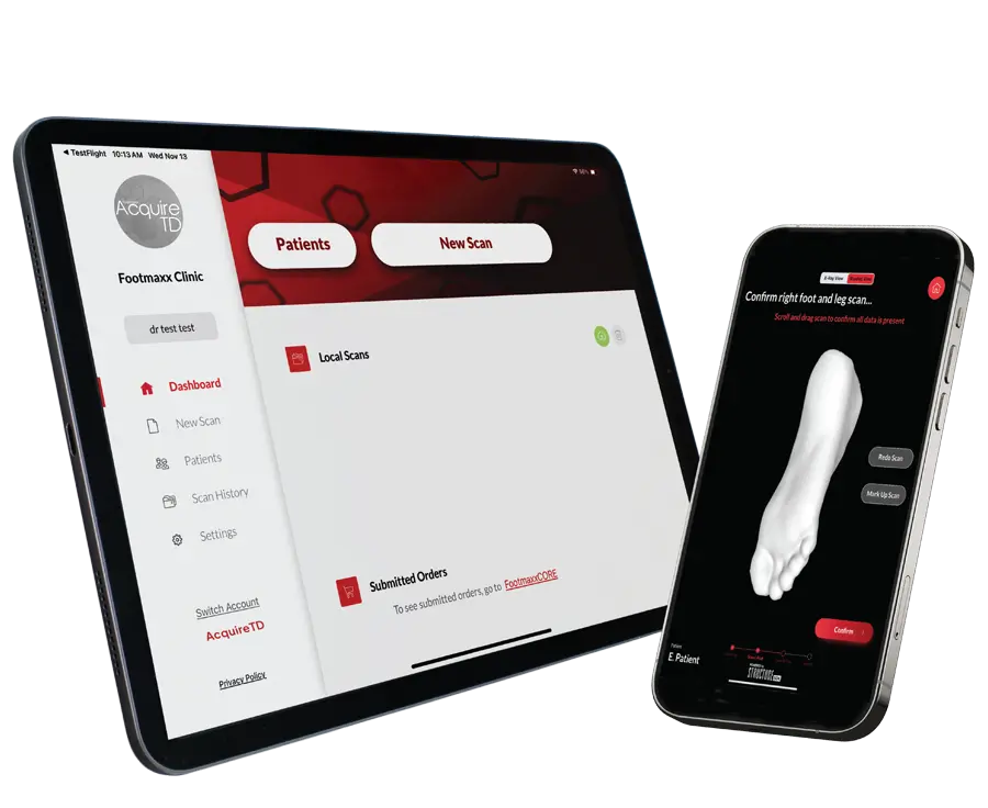 Footmaxx AcquireTD 3D bilateral foot scanning — prescription custom orthotics in Moorhead MN and Fargo ND